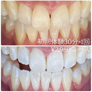 PLATINUM Beauty 横浜店所属・ホワイトニングルーム 横浜店のその他イメージ