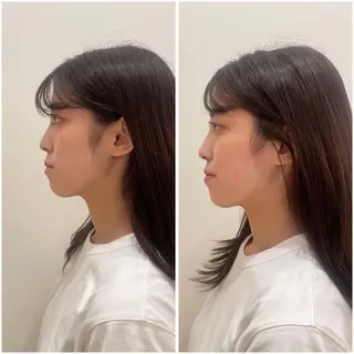 美容鍼サロンメゾンブランシェ所属・🌸美容鍼サロン🌸 メゾンブランシェ🌈のエステ・リラクイメージ