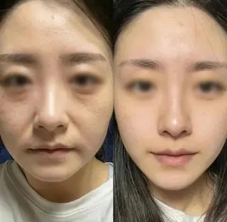 マツエク・マツパ aliaハイフ&水光ジェットサロン所属・aliaハーブ水光店 エステティシャン募集のエステ・リラクイメージ