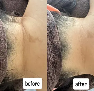 salonvilla所属・villa ☺︎草山 楓花のエステ・リラクイメージ