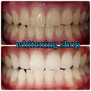 ホワイトニングショップ津店所属・ホワイトニング ショップ津店のその他イメージ