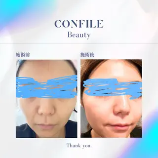 Confile新潟所属・長谷川 由梨奈のエステ・リラクイメージ