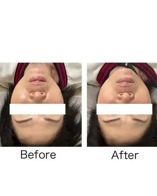 美容鍼灸サロン   colorier所属・美容鍼灸サロン colorierのエステ・リラクイメージ