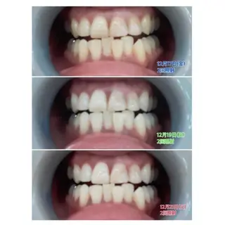 M渋谷店所属・M渋谷 ホワイトニングのエステ・リラクイメージ