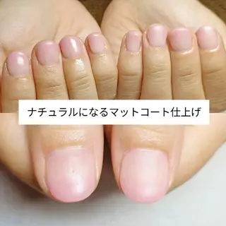 ネイル 深爪矯正/爪育成ケア manie nailのネイルデザイン