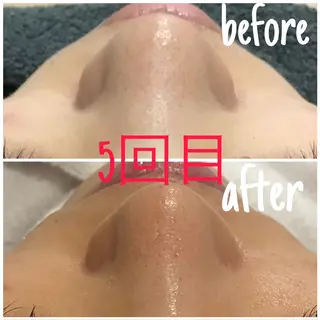 アルカンジュ~archange~所属・痩身/毛穴洗浄/脱毛 アルカンジュのエステ・リラクイメージ