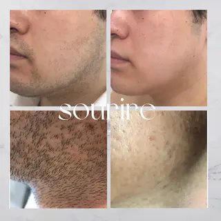 メンズ sourire麻布十番店所属・sourire スリールのエステ・リラクイメージ