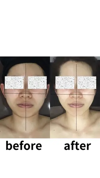 小顔コルギ💎 ABBY SANOのエステ・リラクイメージ