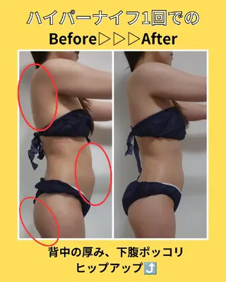 private salon TOWA所属・東洋✖️西洋痩身 TOWA♡関内馬車道のエステ・リラクイメージ