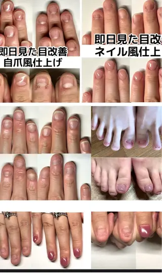 ネイル 深爪矯正専門店ネイルサロンKUU所属・ネイルサロン KUUのネイルデザイン