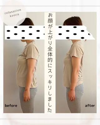 小顔矯正& 慢性肩こり腰痛改善店のエステ・リラクイメージ