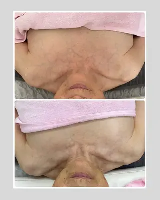 Salon Rion所属・Rion 野々村のエステ・リラクイメージ