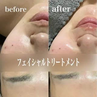 磐田｜LAYLA 一番丁寧な脱毛店のエステ・リラクイメージ