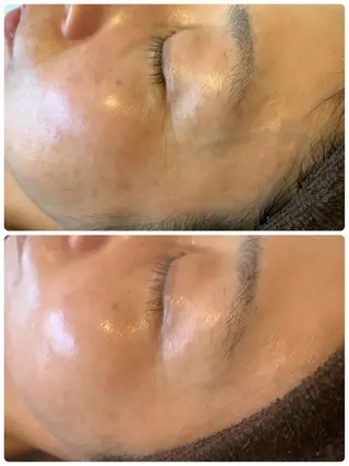 espoir エスポワールのエステ・リラクイメージ