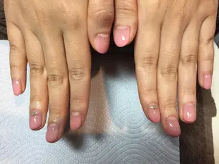 ネイル 深爪・巻き爪 専門サンセリテのネイルデザイン