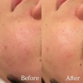 Hari Lounge恵比寿所属・chika🦋 ハリラウンジ恵比寿のエステ・リラクイメージ