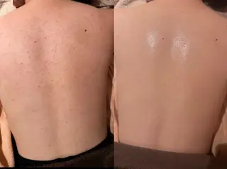 for woman所属・森 美優のエステ・リラクイメージ