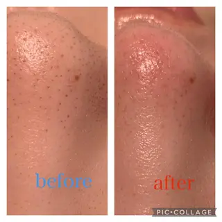 エステティックサロンアトリエホミィ所属・エステティックサロン アトリエ　ホミィのエステ・リラクイメージ