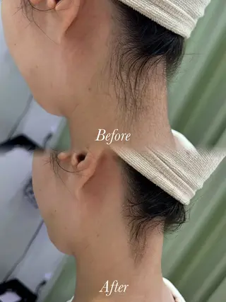 🫧美しい素肌へ🫧 今成柚乃のその他イメージ