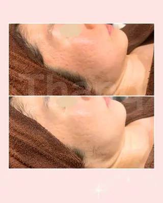 【エイジングケア肌質改善フェイシャル専門】Thanq-サンク-所属・サンク 飯田（イイダ）のエステ・リラクイメージ