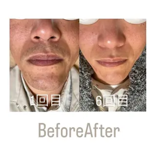 メンズ メンズサロンGRACE所属・salon GRACEのエステ・リラクイメージ