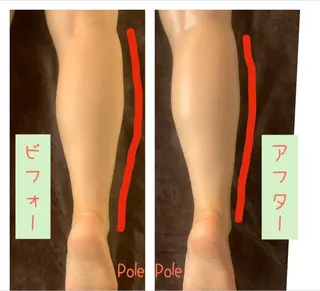 キッズ Pole Poleのエステ・リラクイメージ