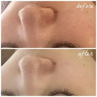 メンズ メナード岐阜市茜部 杉浦のエステ・リラクイメージ