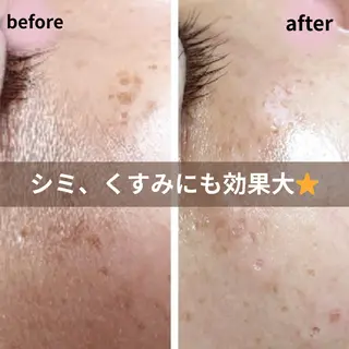 からだ びよりのエステ・リラクイメージ