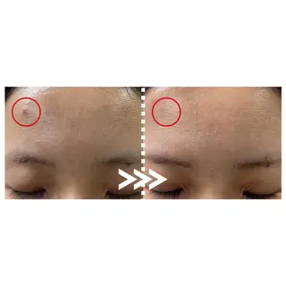 肌質改善専門 ハーブ /毛穴洗浄 リエイトのエステ・リラクイメージ