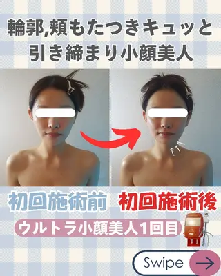 痩身ハーブピーリング 筋膜リリース☆B&Hのエステ・リラクイメージ