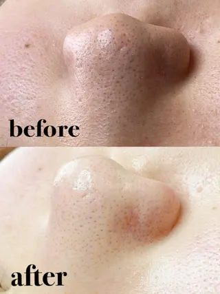 多摩境Beauty Salon  ViVi所属・多摩境ViVi chinamiのエステ・リラクイメージ