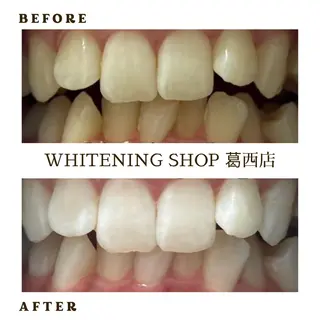 メンズ ホワイトニング ショップ葛西店のその他イメージ