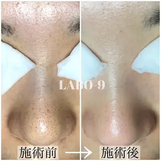 LABO-9所属・田中 捺未のエステ・リラクイメージ