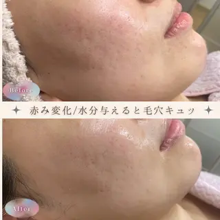 肌質改善プライベートサロンwith U所属・肌質改善サロン with Uのエステ・リラクイメージ