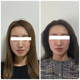 くつろぎ小顔サロン Lu mellow所属・片山けいこ| 美人顔創りの専門家のエステ・リラクイメージ