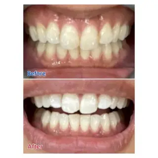 M渋谷店所属・M渋谷 ホワイトニングのエステ・リラクイメージ