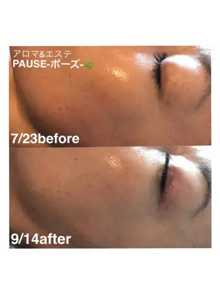 浜野 恵美のエステ・リラクイメージ