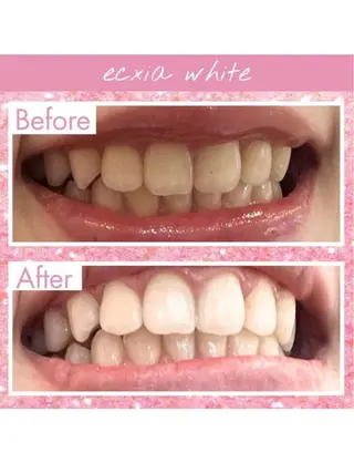 セルフホワイトニングサロン　エクシアホワイト西尾店所属・エクシアホワイト西尾 堀内恵のその他イメージ