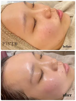 ビューティーサロン Lino🫧mayuのエステ・リラクイメージ