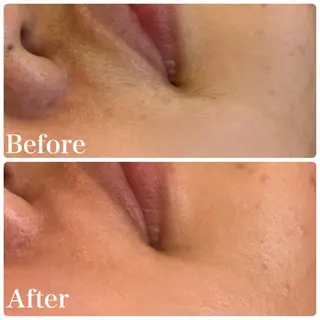 LAKI eye&face  studio所属・LAKI studioのエステ・リラクイメージ