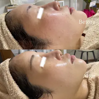 北浜/毛穴洗浄ツヤ肌 サロンaniRのエステ・リラクイメージ