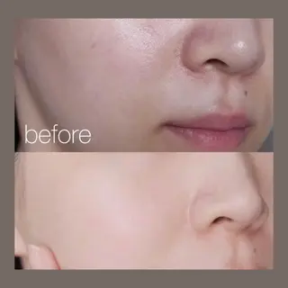 愛維美水光美肌専門店所属・愛維美水光美肌専門店 メンズレディースokのエステ・リラクイメージ