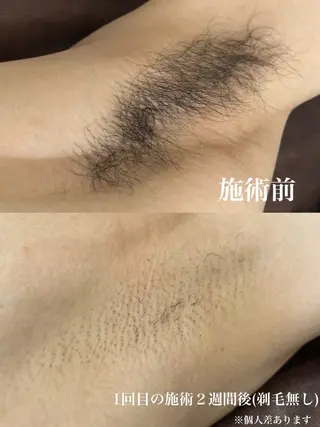 メンズ muumo所属・muumo まりののエステ・リラクイメージ