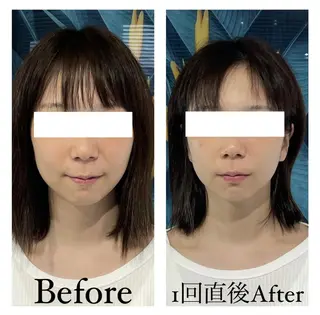 部分痩せ♥️小顔専門 MIKUのエステ・リラクイメージ