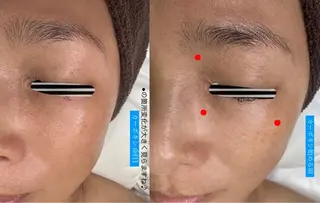 BIREINA Eyelash  Salon所属・BIREINA 住之江公園のマツエク・マツパデザイン