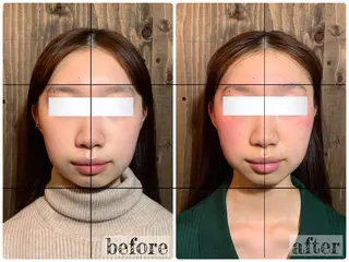 💎後悔させない小顔 矯正💎イトヤマ🌱のエステ・リラクイメージ