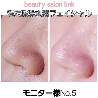 beauty salon  link所属・水素エステと美容脱毛 salon Linkのエステ・リラクイメージ