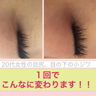 ミディアム パーマ キッズ ネイル マツエク・マツパ ニキビ・肌質改善専門 ♡人生が変わるサロンのエステ・リラクイメージ