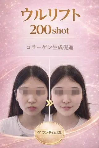 マツエク・マツパ aliaハイフ&水光ジェットサロン所属・aliaハーブ水光店 エステティシャン募集のエステ・リラクイメージ