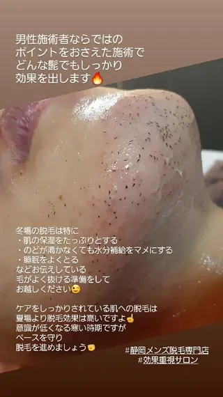 キッズ メンズ メンズ・脱毛サロン DEARS所属・山村幸久 メンズ脱毛 ディアーズのエステ・リラクイメージ